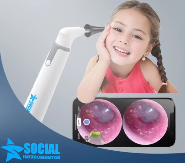 Otoscópio digital Wireless - Imagem 4