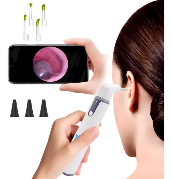 Otoscópio digital Wireless - Imagem 2